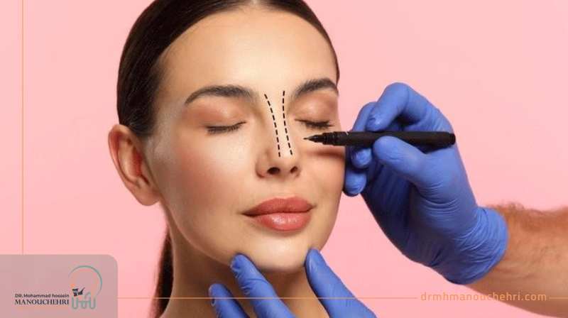جراحی زیبایی بینی در اصفهان دکتر منوچهری